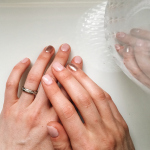 Breaking the nail biting habit